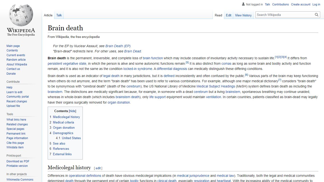 Brain death - Wikipedia
